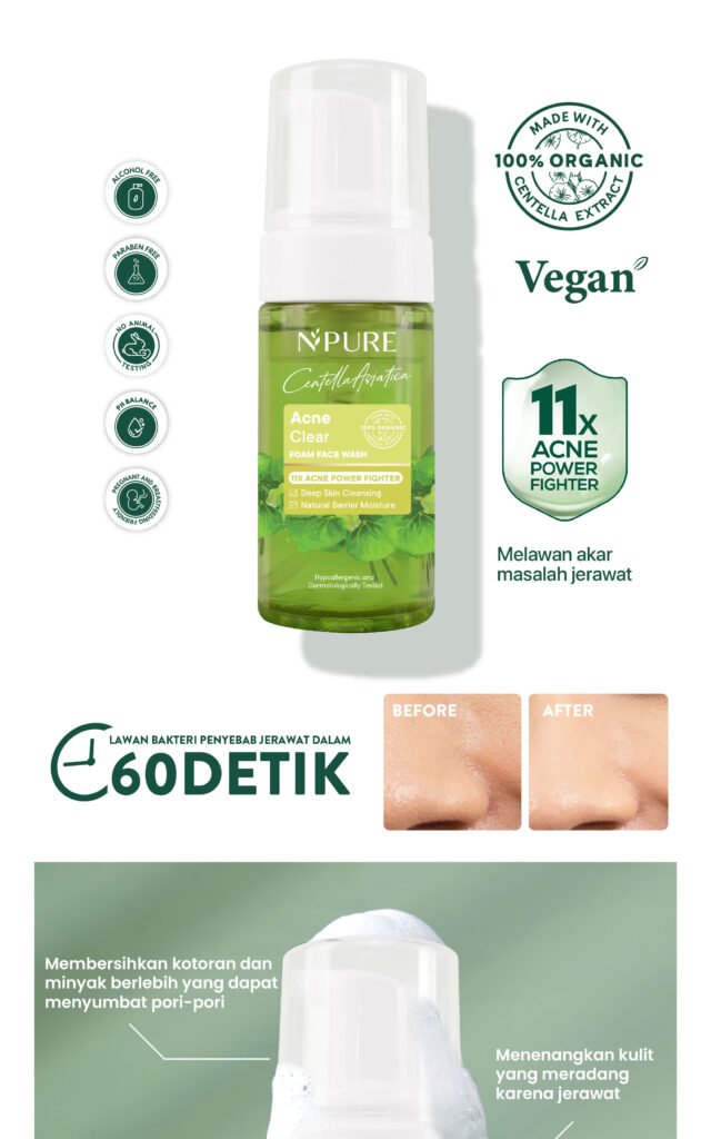 Acial Wash Cica Untuk Kulit Berjerawat NPURE 2 Scaled