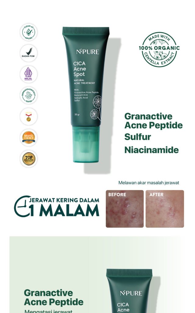 Spot Treatment Vitamin C Bekas Jerawat 5 Scaled